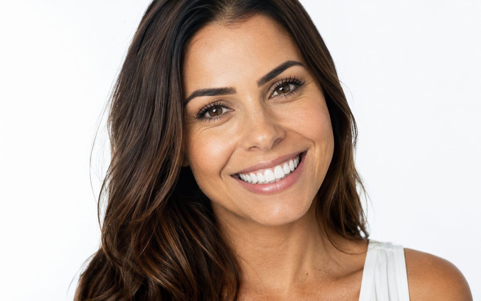 Resultado de clareamento dental — sorriso mais claro na AFO Odontologia